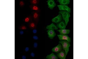 ABIN6256764 and ABIN6267179 staining heat-shock treated Hela cells by IF/ICC. (SHP1 anticorps  (pTyr564))