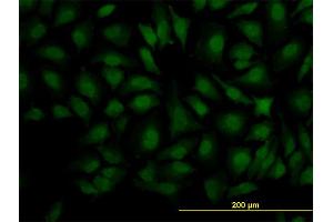 Immunofluorescence of monoclonal antibody to DCPS on HeLa cell. (DCPS anticorps  (AA 1-337))