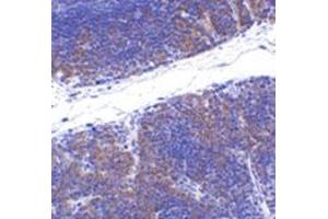 Immunohistochemistry of TNFRSF14 in mouse thymus tissue with this product at 1 μg/ml. (HVEM anticorps  (N-Term))