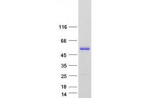 Validation with Western Blot