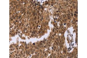 Immunohistochemistry (IHC) image for anti-Excision Repair Cross-Complementing Rodent Repair Deficiency, Complementation Group 6-Like (ERCC6L) antibody (ABIN2423389) (ERCC6L anticorps)
