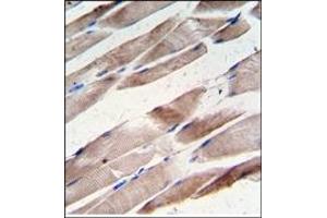 Image no. 1 for anti-Desmin (DES) antibody (ABIN357901)