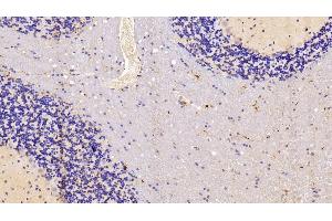 Detection of IBA1 in Rat Cerebellum Tissue using Polyclonal Antibody to Ionized Calcium-binding Adapter Molecule 1 (IBA1)