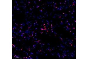 Immunofluorescence of paraffin embedded mouse lung using hmgn1 (ABIN7074222) at dilution of 1: 1000 (250x lens)