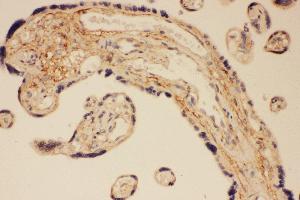 Anti-PSD95 antibody, IHC(P) IHC(P): Human Placenta Tissue