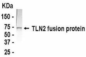 Western Blotting (WB) image for anti-Talin 2 (TLN2) (AA 1750-1950) antibody (ABIN2467893) (TLN2 anticorps  (AA 1750-1950))