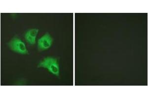 Immunofluorescence analysis of HeLa cells, using Kir5.