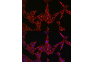 Immunofluorescence analysis of PC-12 cells using GSDME antibody (ABIN6127757, ABIN6139554, ABIN6139555 and ABIN6223304) at dilution of 1:50. (Non-Syndromic Hearing Impairment Protein 5 (GSDME) (AA 1-260) anticorps)