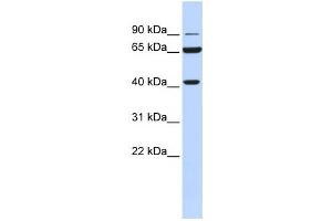 Western Blotting (WB) image for anti-Glucose-6-Phosphate Dehydrogenase (G6PD) antibody (ABIN2459470) (Glucose-6-Phosphate Dehydrogenase anticorps)