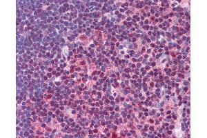 Anti-STAT3 antibody IHC of human thymus.