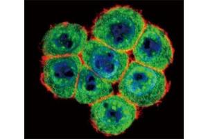 Confocal immunofluorescent analysis of SMAD4 antibody with HeLa cells followed by Alexa Fluor 488-conjugated goat anti-rabbit lgG (green).