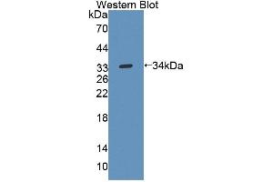 Detection of Recombinant UPP1, Mouse using Polyclonal Antibody to Uridine Phosphorylase 1 (UPP1)