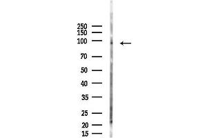 anti-Serine/threonine-Protein Phosphatase 4 Regulatory Subunit 3A (SMEK1) antibody