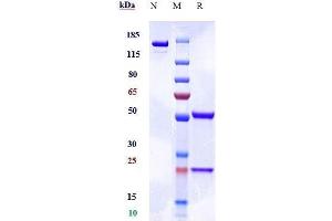 Anti-AGER / RAGE Reference Antibody (XT-M4) on SDS-PAGE under reducing (R) condition.