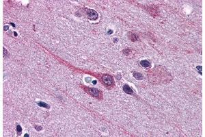 ABIN5867149 (3. (GBX2 anticorps)