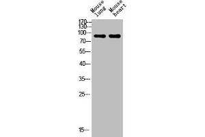Western blot analysis of mouse-lung mouse-heart lysis using NCAM1 antibody. (CD56 anticorps  (Internal Region))