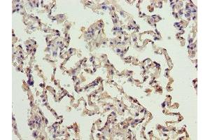 Immunohistochemistry of paraffin-embedded human lung tissue using ABIN7150172 at dilution of 1:100 (ERCC6L2 anticorps  (AA 72-371))
