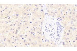 Detection of SGPL1 in Human Liver Tissue using Polyclonal Antibody to Sphingosine 1 Phosphate Lyase 1 (SGPL1)