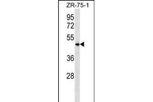 VN1R5 Antibody (Center) (ABIN1538092 and ABIN2849758) western blot analysis in ZR-75-1 cell line lysates (35 μg/lane). (VN1R5 anticorps  (AA 214-241))
