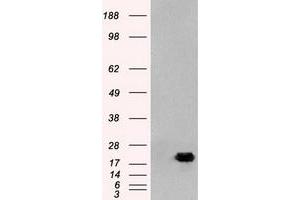 HEK293T cells were transfected with the pCMV6-ENTRY control (Left lane) or pCMV6-ENTRY AK1 (Right lane) cDNA for 48 hrs and lysed. (Adenylate Kinase 1 anticorps)