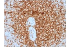 ABIN6383841 to BCL2 was successfully used to stain cells primarily in the germinal centre of human spleen sections.