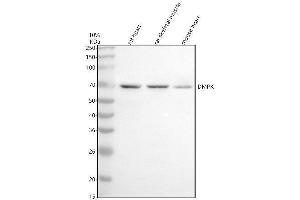 Western blot analysis of DMPK using anti-DMPK antibody (ABIN7603213).