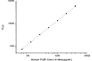 Typical standard curve (Progesterone Receptor Kit CLIA)