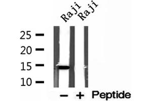 Western blot analysis of extracts of Raji cells, using ISCU antibody.
