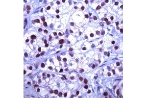 Human prostate stained with anti-SKP2 (SKP2 anticorps  (AA 221-425))