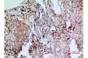Immunohistochemistry (IHC) analysis of paraffin-embedded Human Lung, antibody was diluted at 1:100.