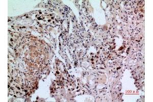 Immunohistochemistry (IHC) analysis of paraffin-embedded Human Lung, antibody was diluted at 1:100. (NFATC1 anticorps  (C-Term))