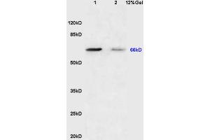 Lane 1: mouse brain lysates Lane 2: mouse lung lysates probed with Anti Sema7A/CD108 Polyclonal Antibody, Unconjugated (ABIN749363) at 1:200 in 4 °C. (SEMA7A anticorps  (AA 351-450))