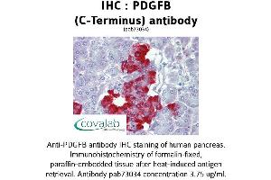 Image no. 1 for anti-Platelet Derived Growth Factor Subunit B (PDGFB) (C-Term) antibody (ABIN1737934) (PDGFB anticorps  (C-Term))