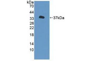 Detection of Recombinant P2RX7, Human using Polyclonal Antibody to Purinergic Receptor P2X, Ligand Gated Ion Channel 7 (P2RX7) (P2RX7 anticorps  (AA 47-334))