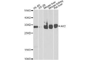 Western blot analysis of extracts of various cell lines, using AK2 antibody (ABIN2560999) at 1:1000 dilution. (Adenylate Kinase 2 anticorps)