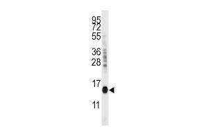 Western blot analysis of anti-CDA Antibody (C-term) (ABIN389393 and ABIN2839485) in mouse kidney tissue lysates (35 μg/lane). (CDA anticorps  (C-Term))