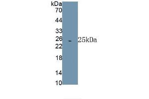 Detection of Recombinant HSPA5, Rat using Polyclonal Antibody to Heat Shock 70 kDa Protein 5 (HSPA5)