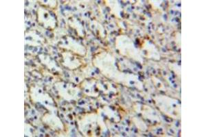IHC-P analysis of Spleen tissue, with DAB staining. (LAT anticorps  (AA 33-227))