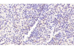 Detection of GOLPH2 in Human Spleen Tissue using Polyclonal Antibody to Golgi Phosphoprotein 2 (GOLPH2)