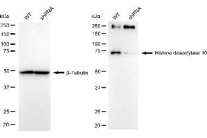 Western blotting analysis using histone deacetylase 10 antibody (ABIN7798926). (Recombinant HDAC10 anticorps)
