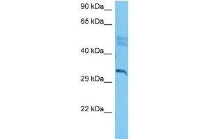 Host:  Mouse  Target Name:  CDK5  Sample Tissue:  Mouse Brain  Antibody Dilution:  1ug/ml
