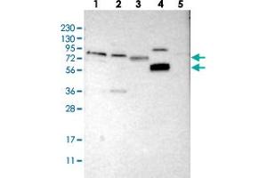 Western blot analysis of Lane 1: RT-4, Lane 2: U-251 MG, Lane 3: Human Plasma, Lane 4: Liver, Lane 5: Tonsil with FRRS1 polyclonal antibody . (Ferric-Chelate Reductase 1 (FRRS1) anticorps)