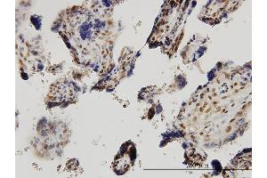 Immunoperoxidase of monoclonal antibody to SMAD2 on formalin-fixed paraffin-embedded human placenta.