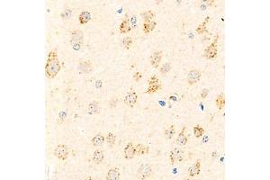 Immunohistochemistry analysis of paraffin-embedded mouse brain using,Arp2 (ABIN7072895) at dilution of 1: 800 (ARPC1B anticorps)
