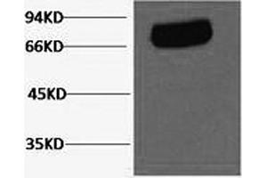 Western Blotting (WB) image for anti-Transferrin (TF) antibody (ABIN5962683) (Transferrin anticorps)