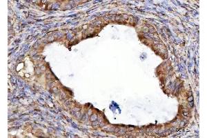IHC analysis of RPL36 using anti-RPL36 antibody (ABIN7602917). (RPL36 anticorps  (C-Term))