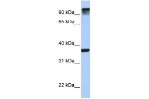 WB Suggested Anti-EPS15 Antibody Titration: 0. (EPS15 anticorps  (C-Term))
