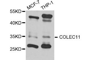 Western blot analysis of extract of MCF7 and THP1 cells, using COLEC11 antibody.