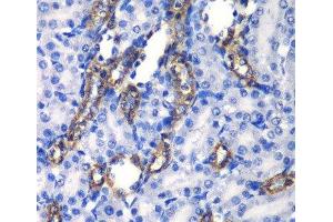 Immunohistochemistry of paraffin-embedded Rat kidney using MATK Polyclonal Antibody at dilution of 1:100 (40x lens).