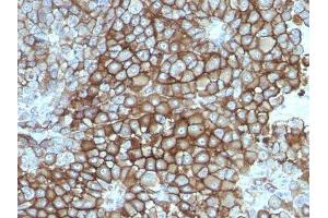 Image no. 1 for anti-Melanoma Marker antibody (ABIN6157176) (Melanoma Marker anticorps)
